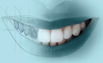 Dentista - Dra. Angélica Rodriguez - Endodoncia