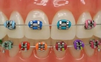 Brackets con Estilo