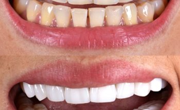 Dental Care Center - Dr Pedro Gorozpe