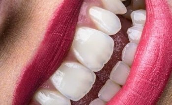 Dentista Guanajuato DG