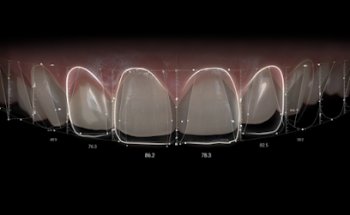 Estética Dental Dra. Karla Ramírez - Best Cosmetic Dentist in Tijuana