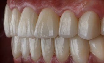 Odontologia Estética OICA: Dentista en Zacatecas