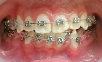 Dra. Michel Anahi Molina Marquez, Dentista - Odontólogo