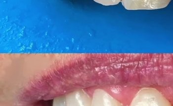 Clinica Dental San Isidro. Dentista