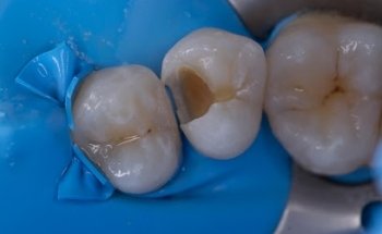 Enamelex Clinica Dental