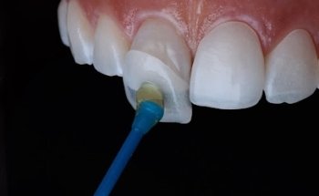 ???????????? Dr. Christian Reyes - Dentista Odontólogo, Estética y Armonización Facial en Tecate