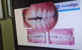 Estética Dental Gozaín