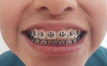 Rosedent Implant & Dental Care | Clinica dental |