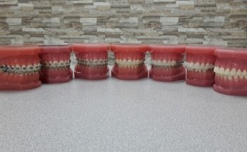 Ortodoncia Especializada U.A.N.L.