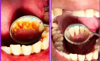 Clínica Dental Del Ángel