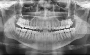 Dendix Laboratorio Digital de Radiología Dental