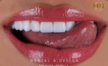 DENTAL & DESIGN MARBELLA