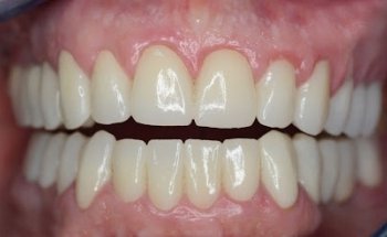 Dentin Odontólogos (Clínica Dental)