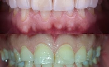 Consultorio Dental Humaya En Culiacan, Dentista Dr. Yusseff O. Rivera