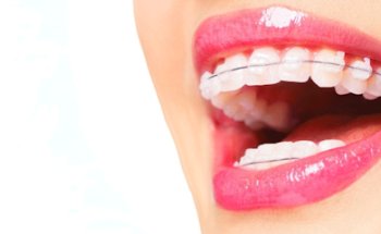 Clínica Dental Adelaida Parra - Dentista Torrelodones