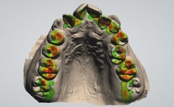 CLINICA DENTAL DEntAle.