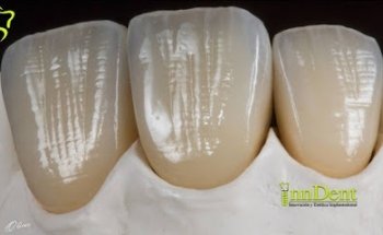 Clínica Dental InnDent