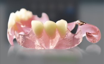 Clemde SA de CV: Partial Flex, LithiumYZR, EZ Modeling, PF Keep, Cerami-K