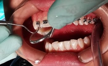 Consultorio Dental C.D. Jovani Morales