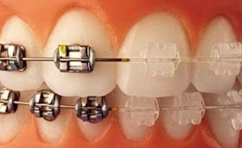 Dental Secret - Previa cita