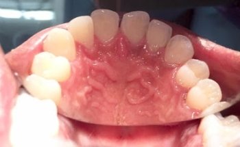 Dental Professionel Dent