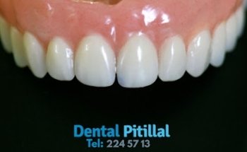 Dental Pitillal