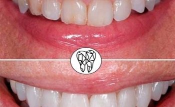 Clínica Arte Dental, Pitillal.