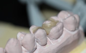 CLÍNICA DENTAL UNIÓN