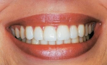 Smile Design Center México