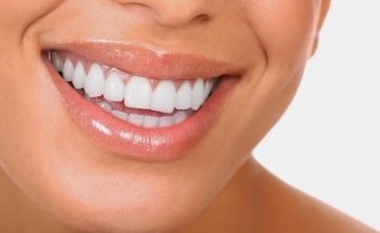 Calidad en Atención Dental