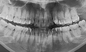 Diseño de Sonrisa Puebla