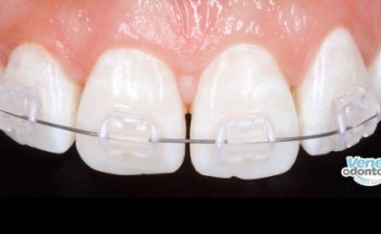 Veneodonto. Dental clinic