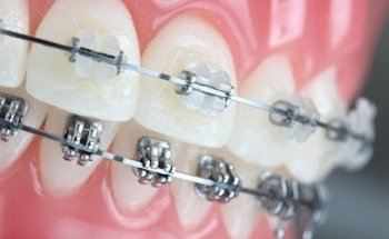 ESPECIALIDADES DENTALES DEL VALLE