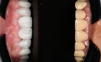 Diseño DentAll Dentilab