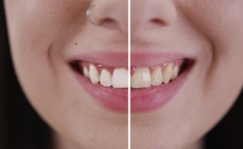 Clinica Dental Myodent Dentista Valdebernardo