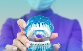 Proesthetic dental care