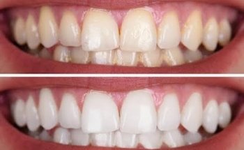 Pro Dental Consultorio Dental