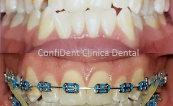 ConfiDent GDL Clínica Dental