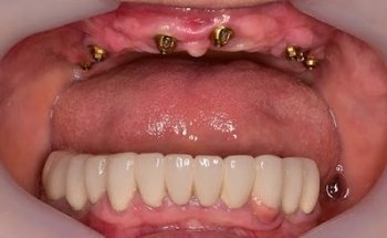 The McMillan Dental Clinic- Exceeding Expectations.