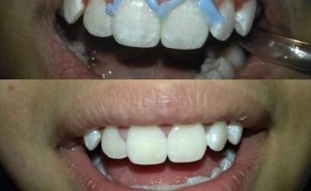 SANTIC (Sonrisa Dent)