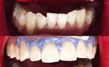 Dentsthetic by CD. Jurado