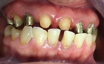 Centro Odontológico Especializado de Veracruz