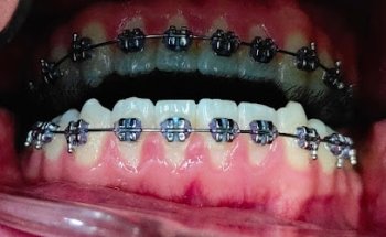 Dr. Javier Jaramillo Odontología Integral y Ortodoncia