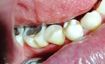 Consultorio Dental Santiago