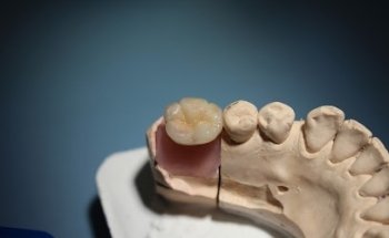 Clinica de Odontologia integral Tlaquepaque.