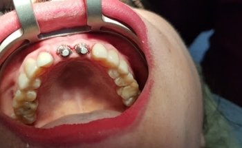 Clínica dental Americana