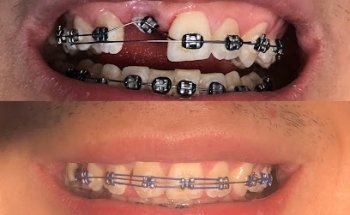 Marfil clínica dental