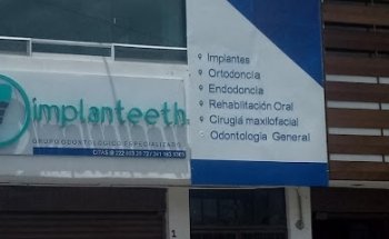 Implanteeth