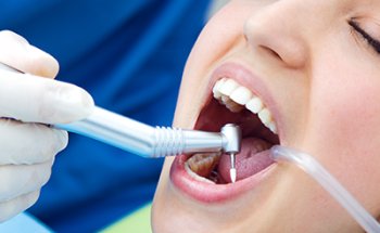 Clínica de implantes dentales