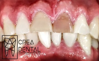 CREA DENTAL